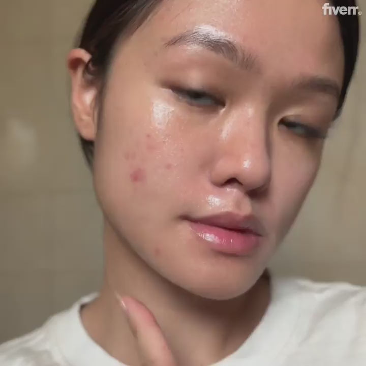 Acne Soothing Gel with SebustopR &amp; Salicylic Acid&nbsp;